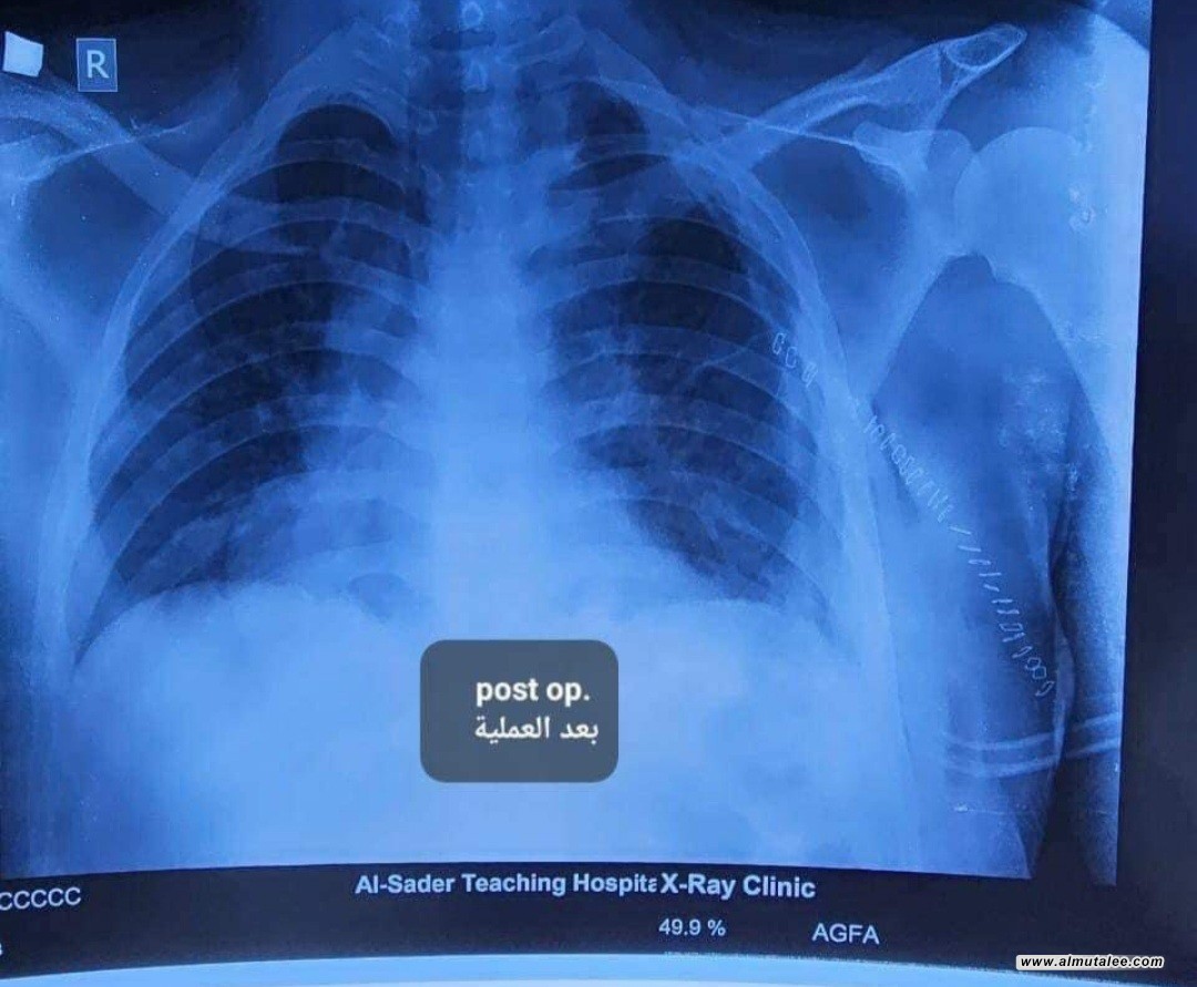 post-image