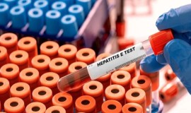 إسبانيا... تسجيل عشرات الإصابات بفيروس التهاب الكبد الوبائي الذي تنقله الفئران