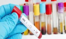 الصحة النيابية: تسجيل "2638" حالة إصابة بالإيدز بالعراق خلال الأعوام الماضية
