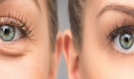 الكشف عن خمس وصفات طبيعية للتخلص من تجاعيد العين... تعرفوا عليها